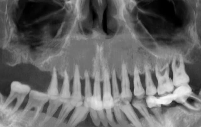 Radiografie inițială